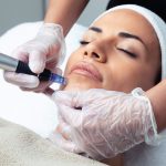 dermapen-microneedling